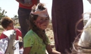 conversations Yazidi child with caked blood